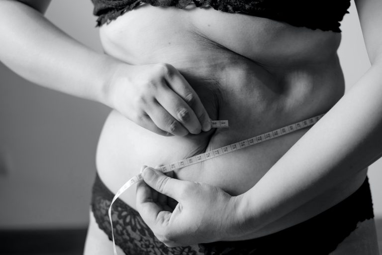 Weight Loss Surgery – Pros and Cons